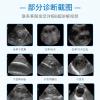 Cattle Pregnancy Diagnosis