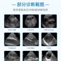 牛B超诊断仪BTS-N40 - SHEWUYOU Livestock Equipment