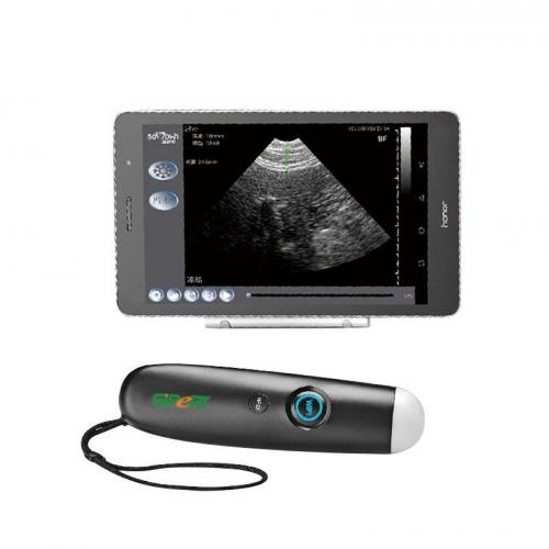 Smart Wireless Veterinary Ultrasound Scanner - SHEWUYOU Livestock Equipment