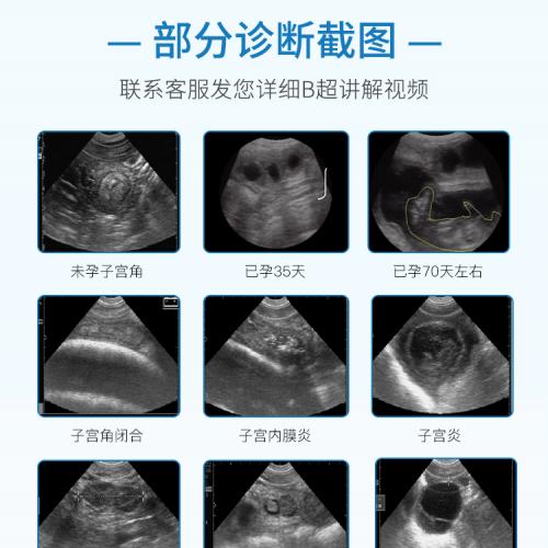 BTS-N40 Bovine Veterinary Ultrasound Scanner - SHEWUYOU Livestock Equipment