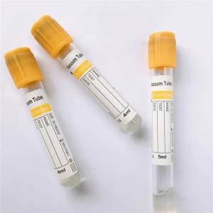 Veterinary Gel & Clot Activator Tube - SHEWUYOU Livestock Equipment