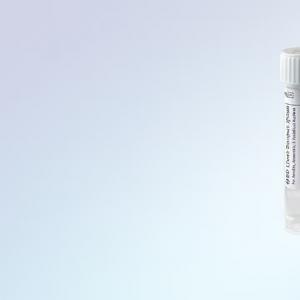 Veterinary Sampling Swab with Transport Medium - SHEWUYOU Livestock Equipment