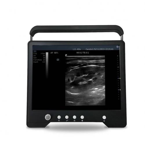 Swine and Sheep Electronic Probe Pregnancy Ultrasound Scanner - SHEWUYOU Livestock Equipment