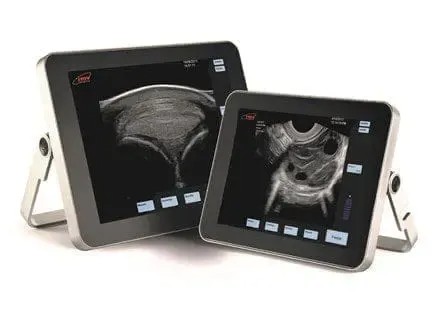 Swine Loin Eye and Muscle Depth Analysis System - SHEWUYOU Livestock Equipment